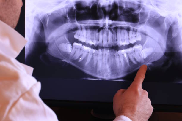 Best Emergency Tooth Extraction  in West Wyomissing, PA