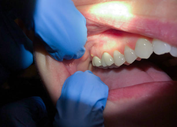 Best Tooth Pain Emergency Relief  in West Wyomissing, PA